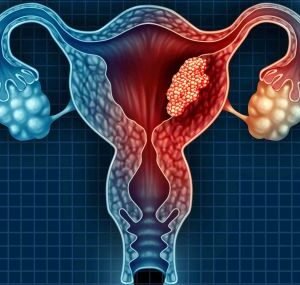 Gynaecology & Obstetrics - I