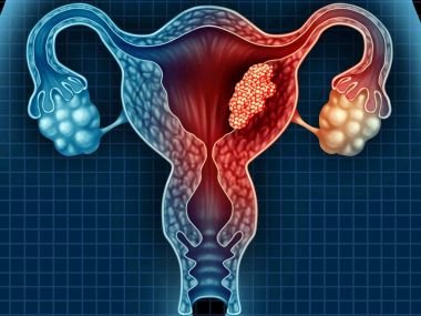 Gynecology